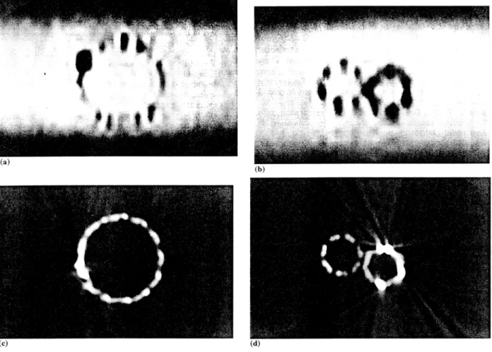 Fig. 3.  MR (a, b)  and  CT (c, d)  images of the stent-graft obtained at  identical location traversing the  platinum marker at  the proximal aortic  portion (a, c) and traversing the platinum marker at the junction of the two stent components in the prox