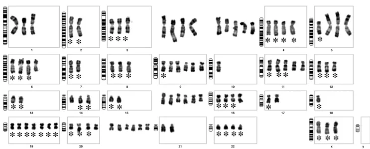 Fig. 2 Complex karyotype of an undifferentiated high-grade pleomorphic. sarcoma. Many chromosomes are abnormal and difficult to classify (asterisk indicates «apparently» normal (i.e., recognizable) chromosomes)