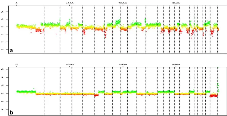 Fig. 4 Genomic profiles established by CGH BAC-array. This molec- molec-ular approach allows us to identify rearranged chromosomal regions in undifferentiated pleomorphic sarcomas