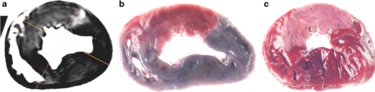 Fig. 1 Comparison between a post-mortem cardiac MR, b fresh porcine heart after staining with Evan’s blue, and c fixed heart specimen, stained with TTC