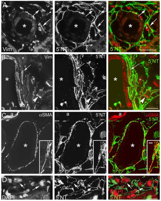 Fig. 2 The inﬂamed peritubular interstitium contains