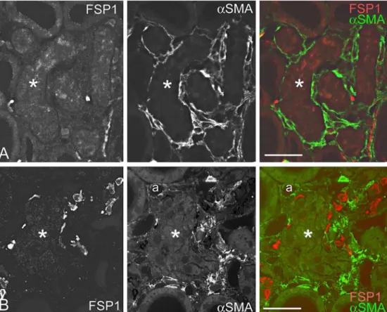 Fig. 5 FSP1/S100A4, but not aSMA, is detected in injured DCTs. Peritubular aSMA is not co-localized with FSP1/