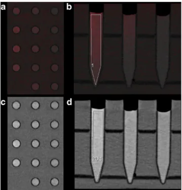 Fig. 1 Virtual iron content (VIC) images derived from dual-energy three-material decomposition of iron and liver tissue (A+B) with corresponding single-energy images (C+D)