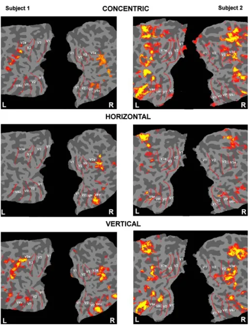 Figure 2 shows the fMRI activation to concentric, horizon- horizon-tal and vertical forms overlaid on Xattened occipihorizon-tal cortex for two example subjects