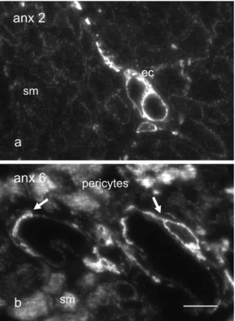 Figure 1. Annexins 2 and 6 are differentially expressed within  endothelial and smooth muscle cells in vivo