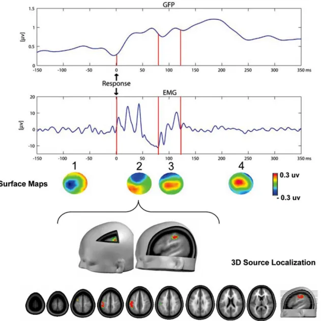 Fig. 5 From the top: GFP , mean EMG of the right flexor digitorum communis, the four segmentation maps identified in the  response-locked MEx and their respective topographies