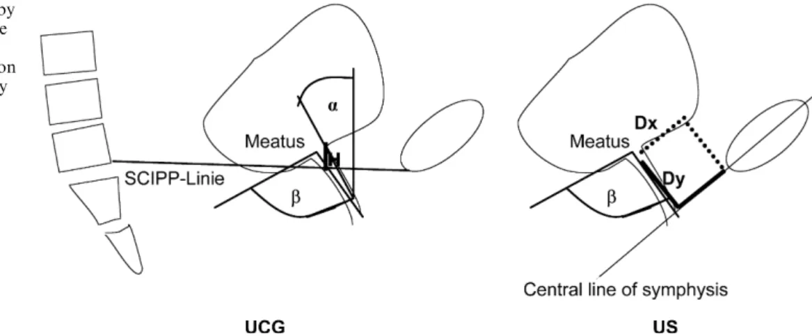Fig. 2 Parameters measured by UCG (distance H between the internal urethral os and the SCIPP line, angle of inclination a, retrovesical angle b) and by US (distance D y between the internal urethral os and the central line of symphysis, distance D x betwee