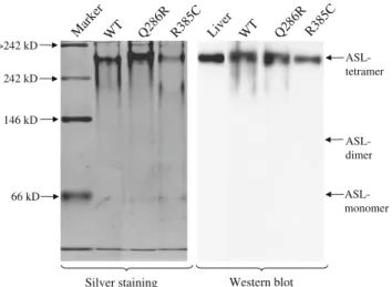 Fig. 2 Native polyacrylamide gel electrophoresis of the wild-type and mutant ASL proteins Q286R and R385C