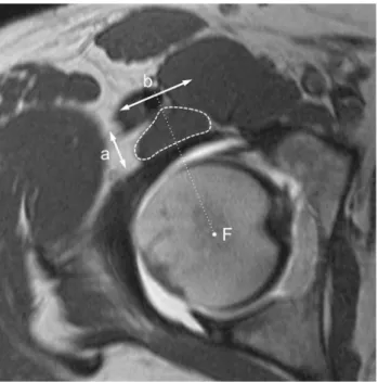 Fig. 2 The cadaver dissection shows the anterior aspect of the hip.