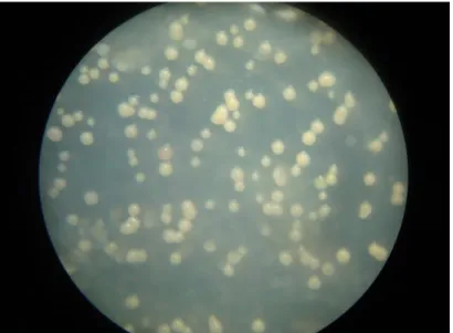 Figure 14 : Micro-colonies de Zymoseptoria tritici, après 06 jours d’incubation   à  24° C, observées sous loupe binoculaire (x5) 