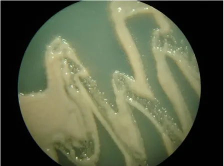 Figure 16 : Conidies de Zymoseptoria  tritici observées  au microscope optique (x 40)   (Photo personnelle)