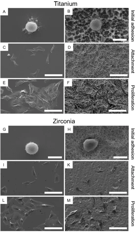 Fig. 4 Representative SEM images of osteoblastic cells cultured on polished and etched titanium as well as zirconia.