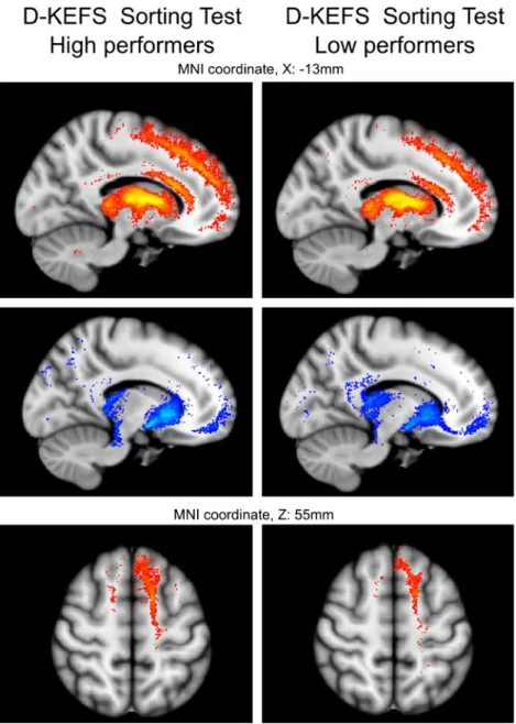 Fig. 3 Anatomy of fiber tracts emerging from the