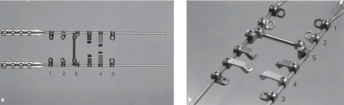 Figure 2. Parallel connectors. They permit to connect any rod system  used in the T-spine with the CerviFix® implanted at the C-spine.