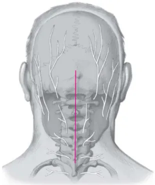 Figure 10. Midline skin incision from the external occipital protuberance to the  spinous process of C7