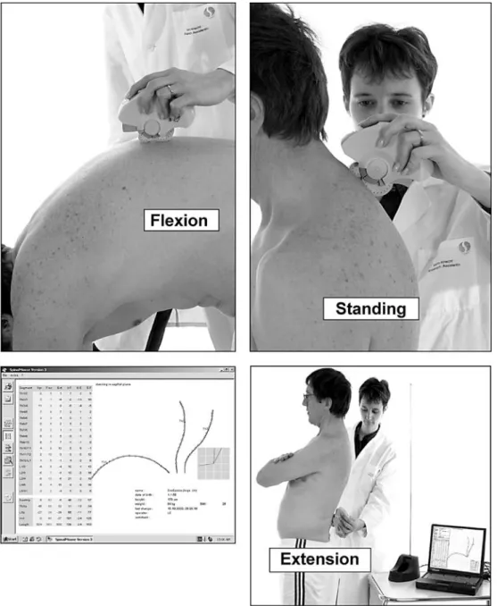 Fig. 1 Spinal Mouse measure- measure-ments in standing position, flexion, and extension and the typical output derived from one set of tests
