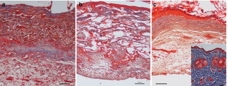 Fig. 3 Neovascularization 14 days after one-step transplantation.