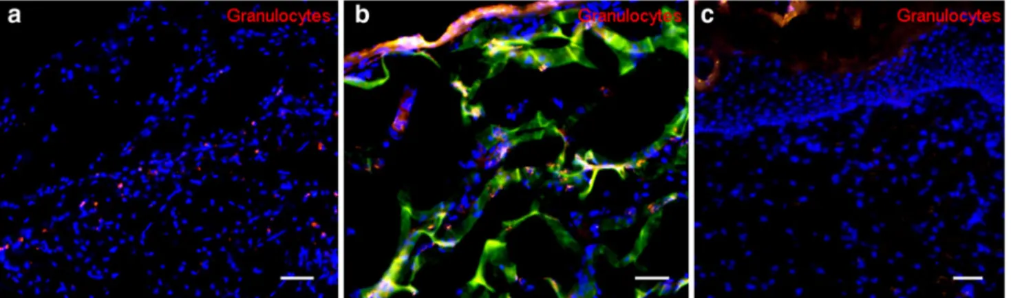 Fig. 5 Inflammatory response (macrophages) 14 days after one-step transplantation. a Matriderm, b Integra Single Layer, c control.