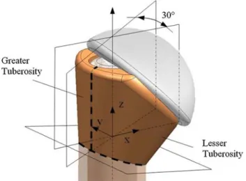 Fig. 1 Geometry of a four-part fracture model on a left humerus according to [16]