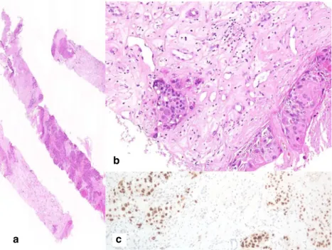 Table 6 Commonly used markers for diagnostic immunohistochemistry: expression in normal kidney and in primary renal and extrarenal tumors