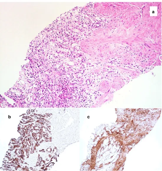 Table 3 Immunohistochemistry for the differential diagnosis of RCC with clear cell features