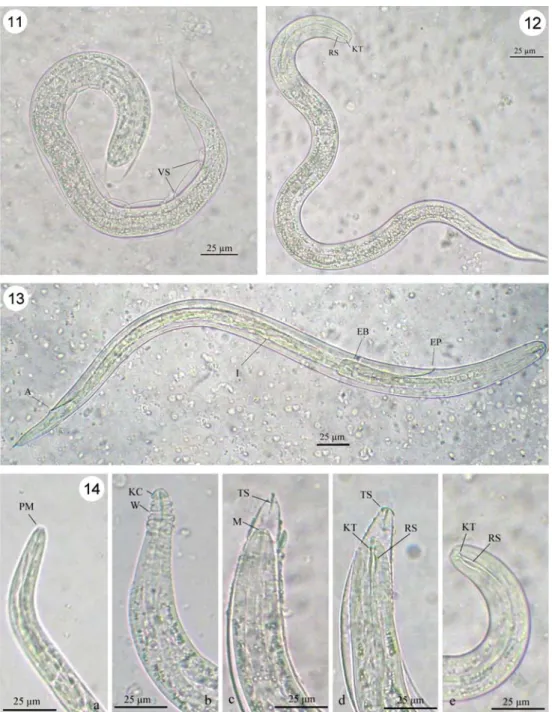 Fig. 14 Features of A. cantonensis larval head at different stages of development;