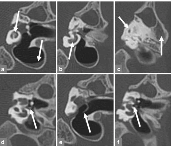 Fig. 1 Coronal section of the left sheep temporal bone.