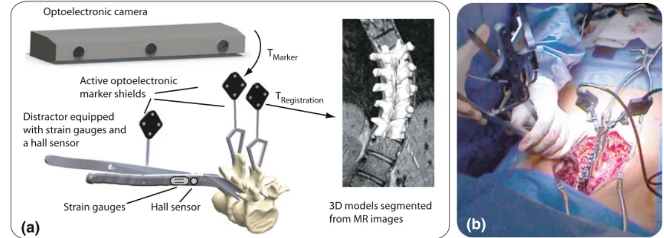 Fig. 1 a Systematic sketch with the main components of the measurement concept: Optotrack 3020 camera (Northern Digital Inc., Waterloo, Canada) for optical tracking of distractor and