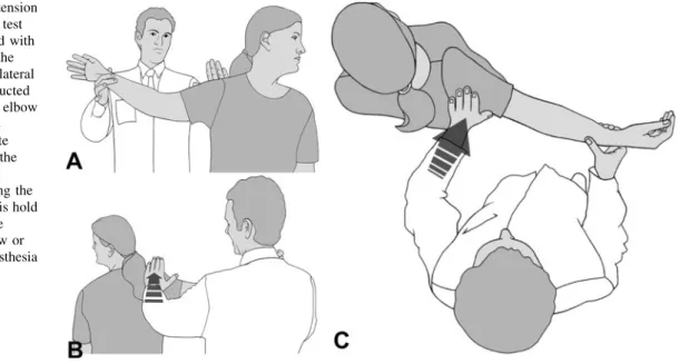 Fig. 2 The abduction extension cervical nerve root stress test (AECNRST) is performed with the patient standing and the head turned to the contralateral side