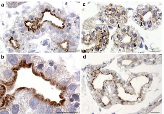 Fig. 7 Subcellular localization of megalin/lrp2 and cubilin by immunelectron microscopy.