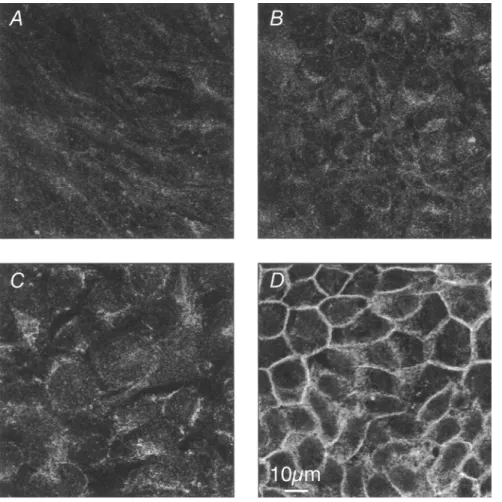 FIG.  5.  Expression  of  E - c a d h e r i n   as  vi-  sualized  by  CLSM.  Cells  were  cultured for the  times  indicated  and  p r e p a r e d   for  CLSM  (see 