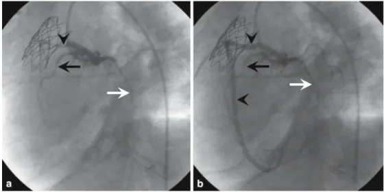 Fig. 3.  a Left oblique view. 