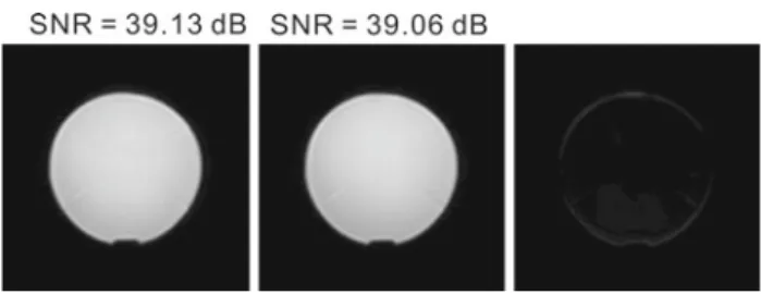 Fig. 8 An example for SNR and subtraction of MRI images. Left phan- phan-tom only; middle device functioning; right subtraction of the previous images