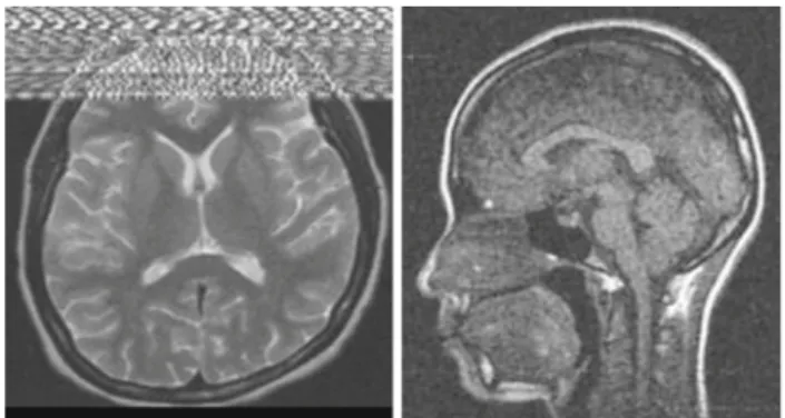 Fig. 7 Lines and speckles in images due to RF interferences