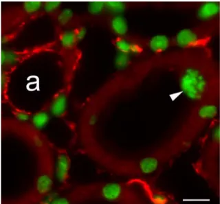 Fig. 5 Absence of vimentin in a mitotic cell (arrowhead) in a proximal tubule. Immunoﬂuorescence for vimentin (red)