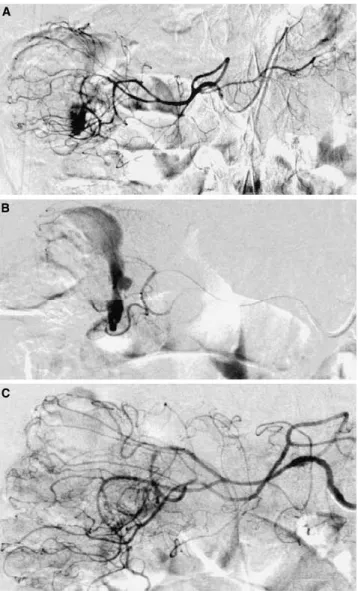 Table 1 summarizes all the final diagnoses, based on the final clinical reports. Angiography was positive in 31% (36 of 118; 11 examinations were performed in  pa-tients who had portal hypertension to check shunt  per-meability or determine vascular anatom