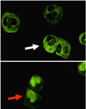 Fig. 1 Testing for antineutrophil cytoplasmic autoantibodies (ANCA) by indirect immunofluorescence using ethanol-fixed neutrophil  sub-strates