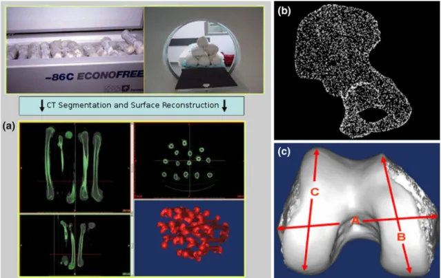 FIGURE 1. (a) Bone bank system showing the different steps of freezing the bones, acquiring CT images, segmenting the volumes, and reconstructing the surfaces in 3D