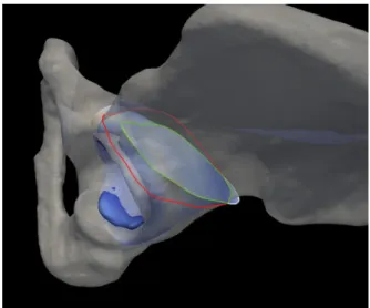 Figure 6 shows an example of overlapping contact sur- sur-faces at the junction area.