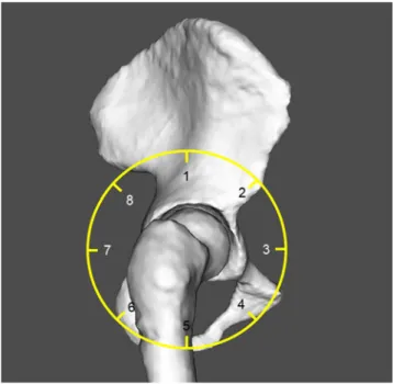 Fig. 2 Acetabulum divided into eight sectors (position 1, superior;