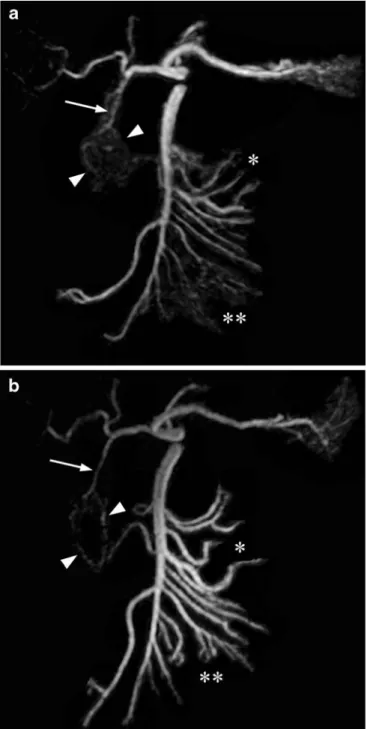 Fig. 2 Frontal maximum intensity projections of the celiac trunk and the superior mesenteric artery (SMA) and their branches reconstructed from coronal 3D contrast-enhanced a conventional (3.5/0.9) and b fast (4.2/1.3) MRA data sets in a 27-year-old man.