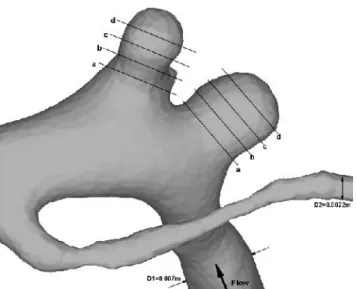 Figure 1. Domain of interest and control cross-sections through the two aneurysms. (Original in colour)
