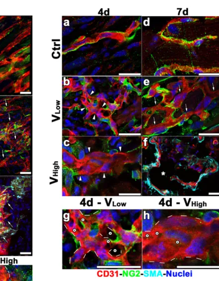 Fig. 3 Mural cell coverage and endothelial morphology during vascular remodeling in limb muscles