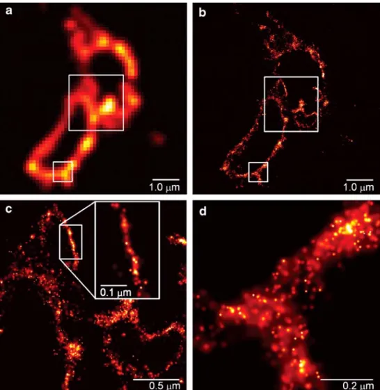 Fig. 1 Comparative summed- summed-molecule total internal  reflec-tion fluorescence (a) and PALM (b) images of the same region within a cryo-prepared thin  sec-tion from a COS-7 cell  express-ing the lysosomal