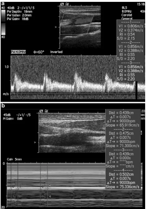 Fig. 1 Flow velocity (a) and vessel diameter in M-mode  ul-trasound (b) measured at the right ICA