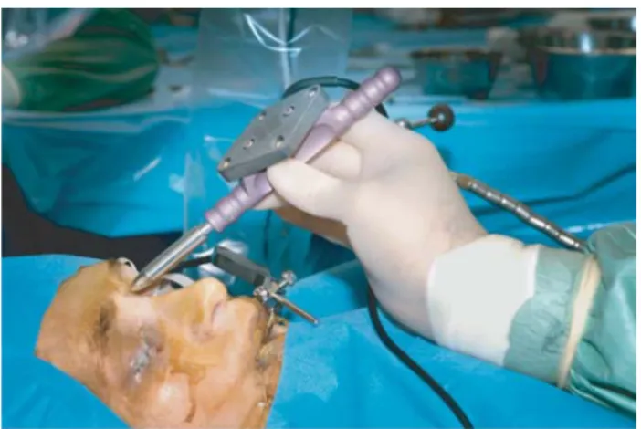 Fig. 4 Registration of the patient to the pre-operative image