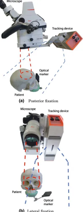 Fig. 5 Two designs for the tracking integration. The position of the tracking camera can be changed depending on the working distance needed for the operation and the position of the patient.