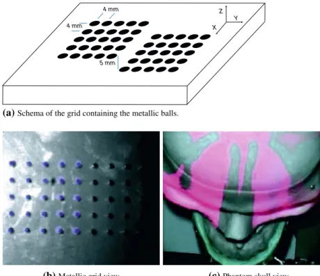 Fig. 9 First evaluation of the accuracy of the overlay system using a custom-made validation grid and a plastic skull phantom 4 mm 4 mm 5 mm X YZ