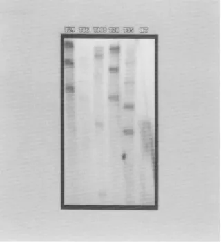 FIG. 2.  PCR analysis of the PRSV coat protein gene in transgenic papaya  plants. Total genomic DNA from transgenic plants T151  (P2-43), and T169  (P31-31), and from a nontransformed plant (NT), as well as a DNA construct  (1421) used  to transform papaya