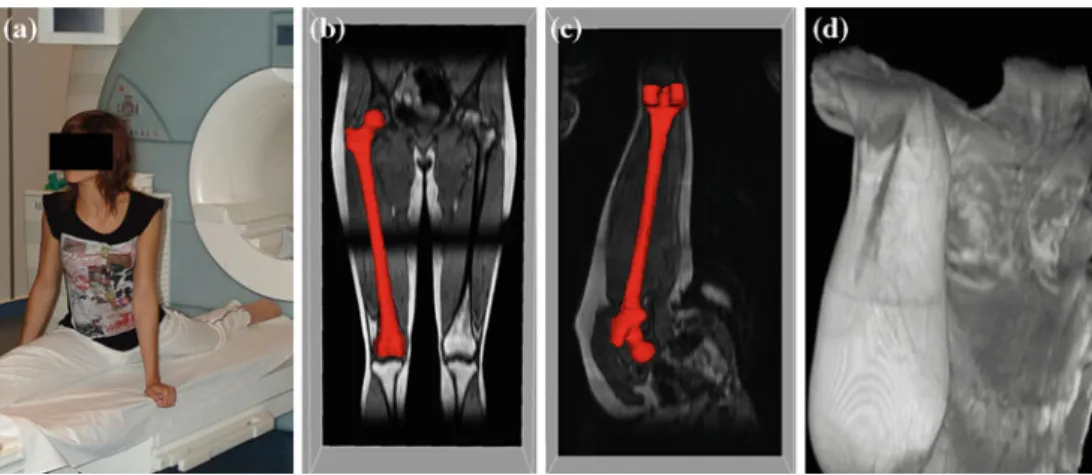 Fig. 1 MRI acquisition: a A volunteer dancer before entering MRI scanner in split posture, a coronal slice of a b supine and c split MRI with bone overlay, d volume rendering of a split MRI